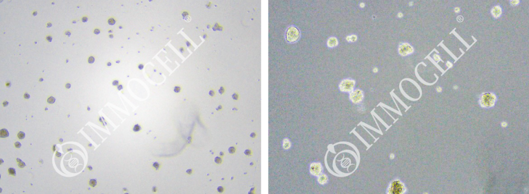 大鼠下丘脑神经干细胞（NSCs）分离培养