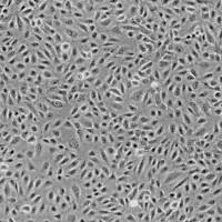 原代细胞永生化