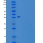 人ORP150 / HYOU1 / HSP12A重组蛋白His tag