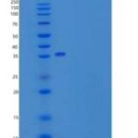 人ORP150 / HYOU1 / HSP12A重组蛋白His tag