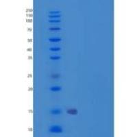人CREB3L1 / OASIS重组蛋白aa 396-519, His tag