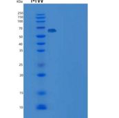 人DUSP14 / MKP-6重组蛋白His & MBP tag