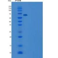 人DUSP14 / MKP-6重组蛋白His & MBP tag