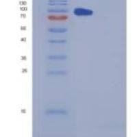 人羧肽酶E(CPE)重组蛋白Fc tag