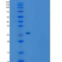 人过氧化还原酶6(PRDX6)重组蛋白His tag