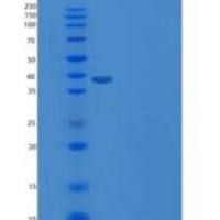 人载脂蛋白H(APOH)重组蛋白His tag