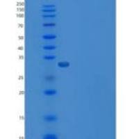 小鼠Carbonic Anhydrase VIII / Car8重组蛋白His tag