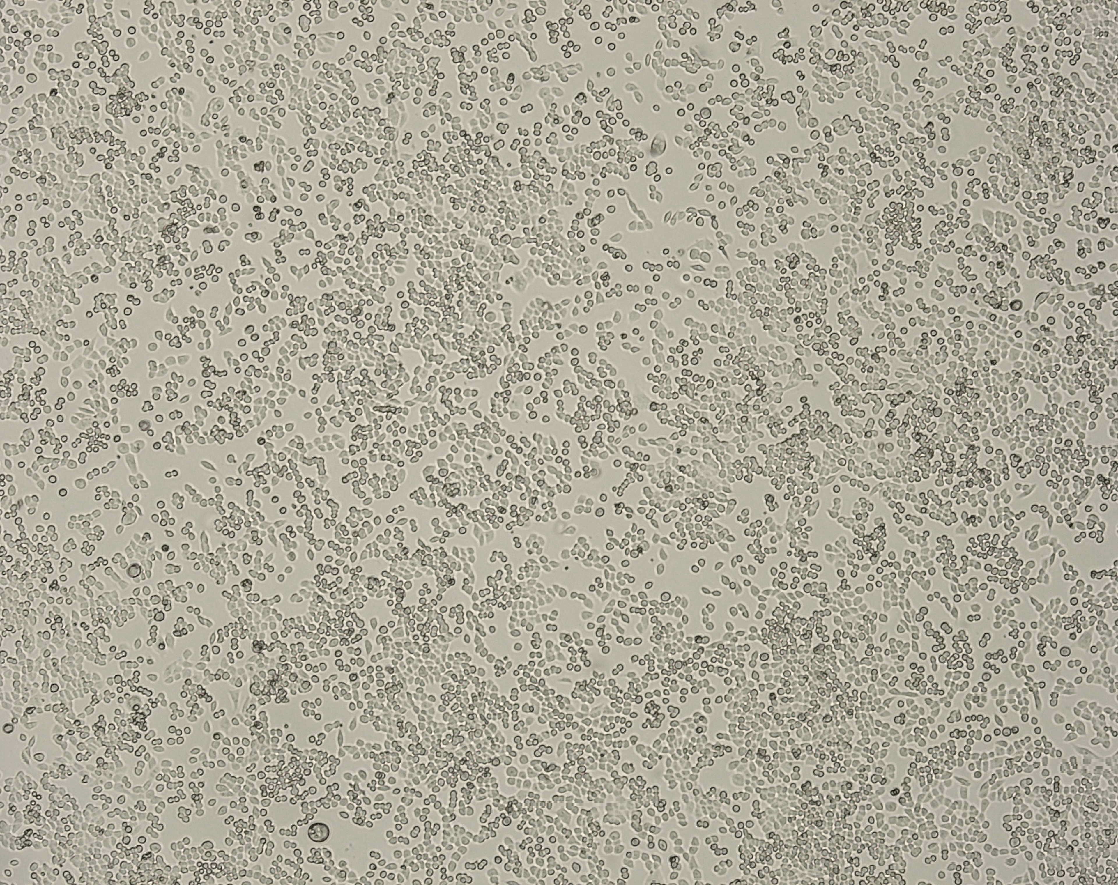 细胞攻略 | LLC(小鼠肺癌细胞)培养教程