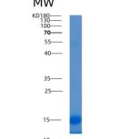 人LAMTOR2 / ROBLD3 / MAPBPIP重组蛋白His tag