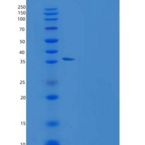 人Resistin / ADSF / RETN重组蛋白Fc Tag