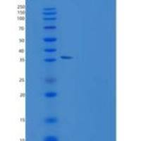 人Resistin / ADSF / RETN重组蛋白Fc Tag