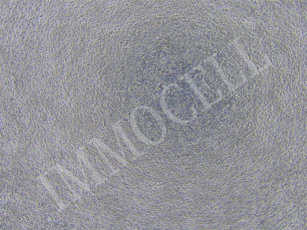 逸漠生物iPSC诱导肺类器官产品