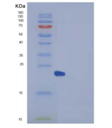 人过氧化还原酶2(PRDX2)重组蛋白His tag