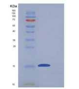 小鼠CD7分子(CD7)重组蛋白His tag