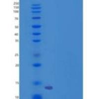 小鼠CD90 / THY-1重组蛋白His tag