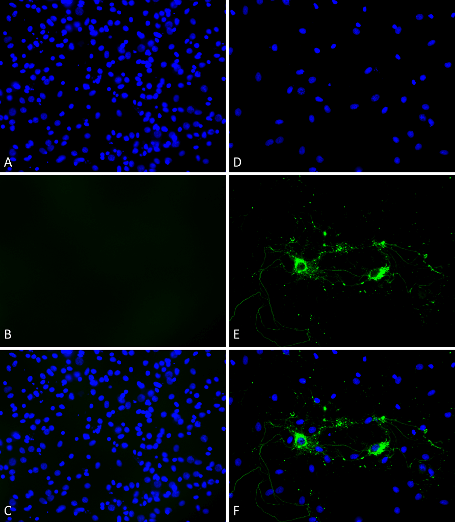 Alpha Synuclein 蛋白前体原纤维Pre-for