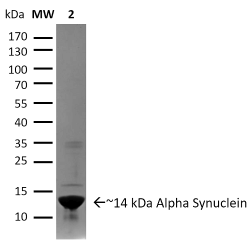 Alpha Synuclein 蛋白前体原纤维 Pre-fo