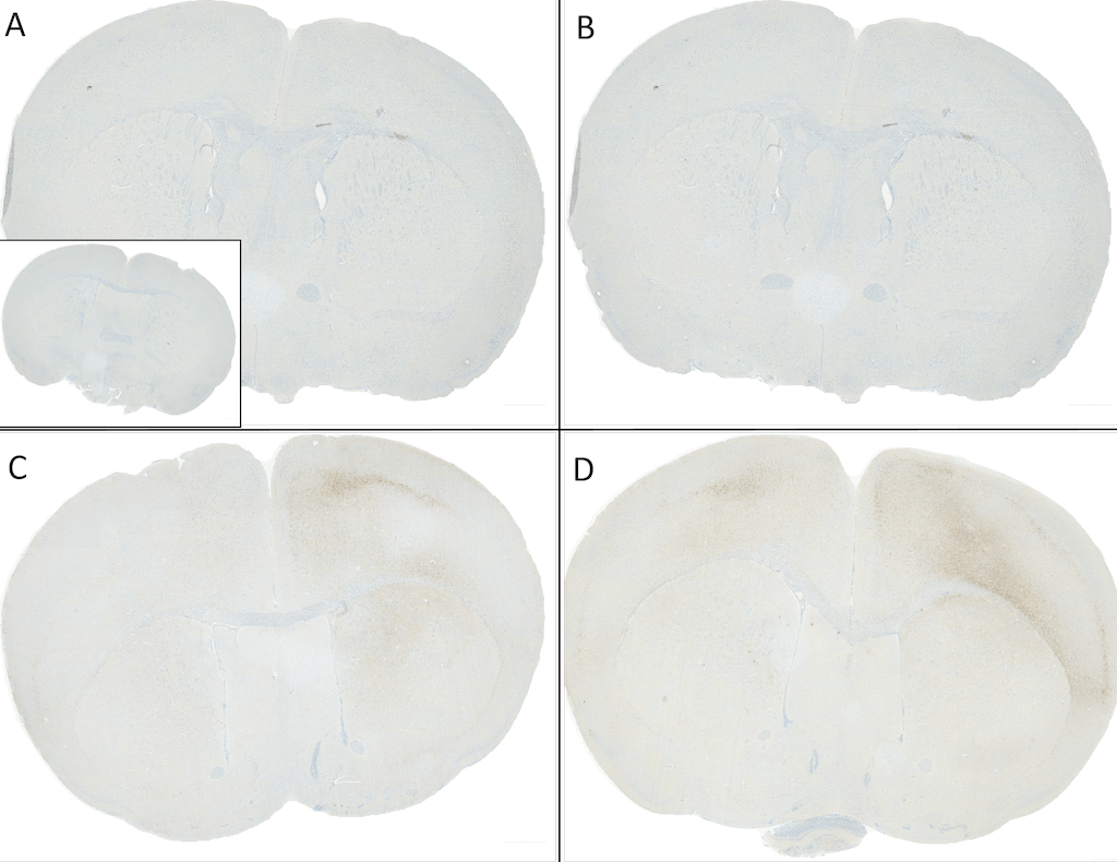 Alpha Synuclein 蛋白前体原纤维Pre-for