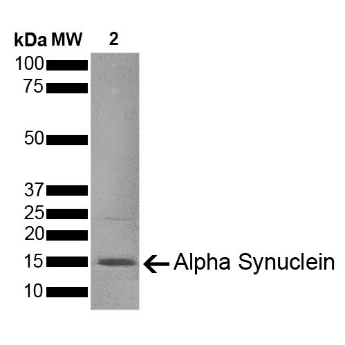 活性Alpha-突触核蛋白前体原纤维 PFFs (1 型)