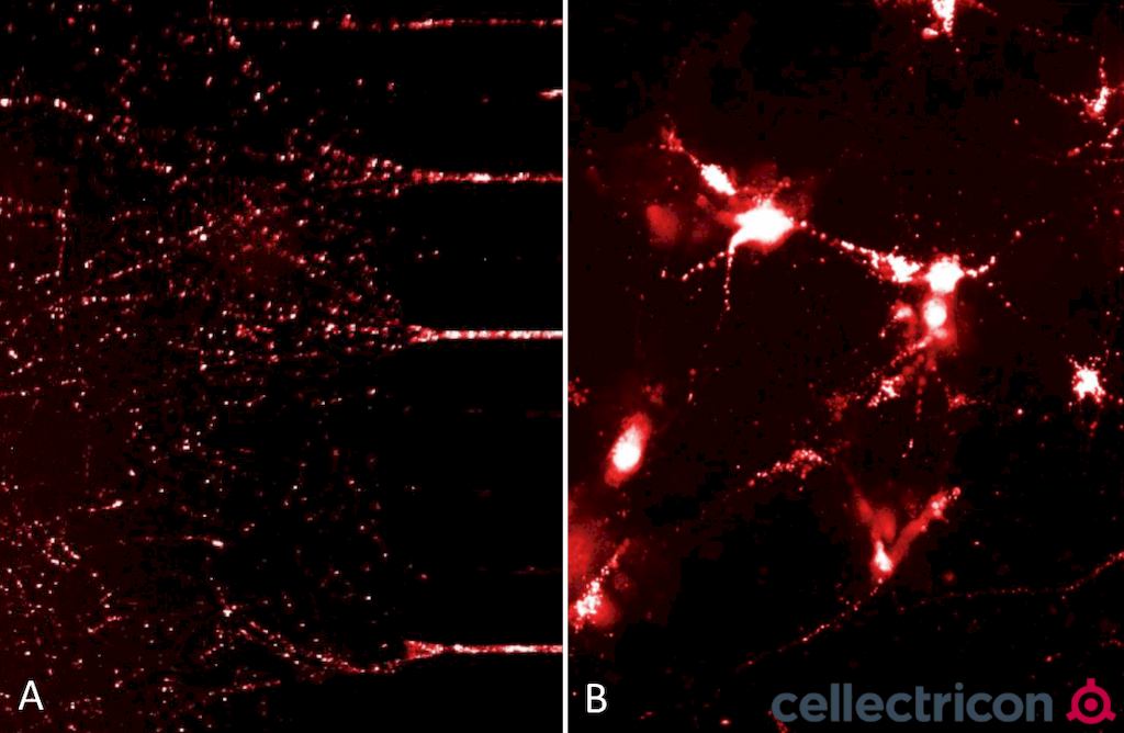 Alpha Synuclein 蛋白前体原纤维 Pre-fo
