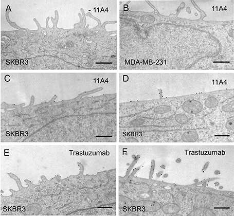 【阿拉丁】胶体金在电子显微镜领域的应用