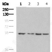 Beta tubulin mouse monoclonal antibody