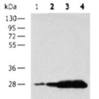 GST tag mouse monoclonal antibody