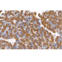 兔抗人甲胎蛋白单克隆抗体