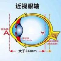 动物实验丨近视眼动物模型