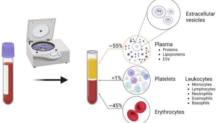 探秘血液奥秘：初学者必读的血浆/血清EVs研究指南！