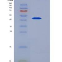 小鼠SerpinI1 / Neuroserpin重组蛋白His tag