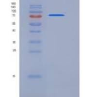 小鼠ADAM15 / MDC15重组蛋白His tag
