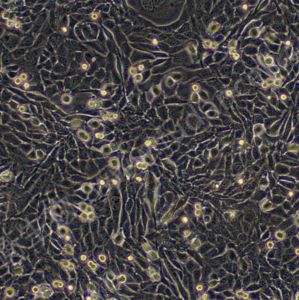 小鼠胰腺癌细胞（B类）带绿色荧光；Pan02/GFP