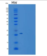 小鼠乙二醛酶Ⅰ(GLO1)重组蛋白His tag