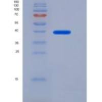 大鼠IL-6R / CD126重组蛋白ECD, His tag