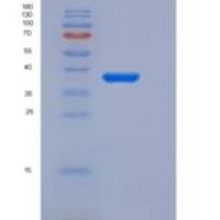 人酰基磷酸酶2(ACYP2)重组蛋白GST Tag