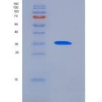 人PDK / PDZ binding kinase / TOPK重组蛋白His tag