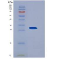 大鼠ADP核糖转移酶4(ART4)重组蛋白His tag