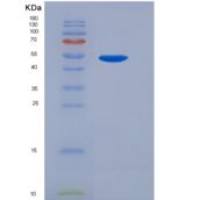 人Galactolipase / PNLIPRP2重组蛋白His tag