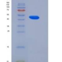 人GADD45A / DDIT-1重组蛋白His & GST tag