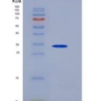 人EDNRB /内皮素B受体重组蛋白Fc tag