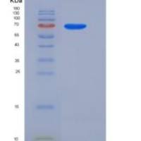 人SEMA6A重组蛋白His tag