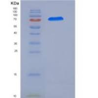 人CAMKV重组蛋白His & GST tag