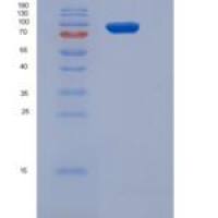 人STK23 / MSSK1 / SRPK3重组蛋白His & GST tag