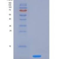 小鼠FKBP12 / FKBP1A重组蛋白His tag