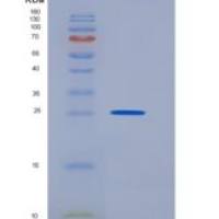 人PARM1 / PARM-1重组蛋白His Tag