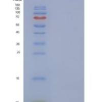 人GNGT1 / GNG1重组蛋白His tag