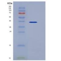 人GPD1 /甘油磷酸脱氢酶1重组蛋白His tag