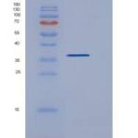 人TSPAN8 / Tetraspanin 8 / TM4SF3重组蛋白Fc tag