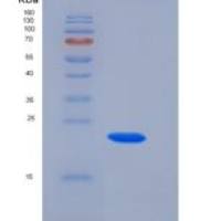 大鼠含胶原三螺旋重复蛋白1(CTHRC1)重组蛋白His Tag